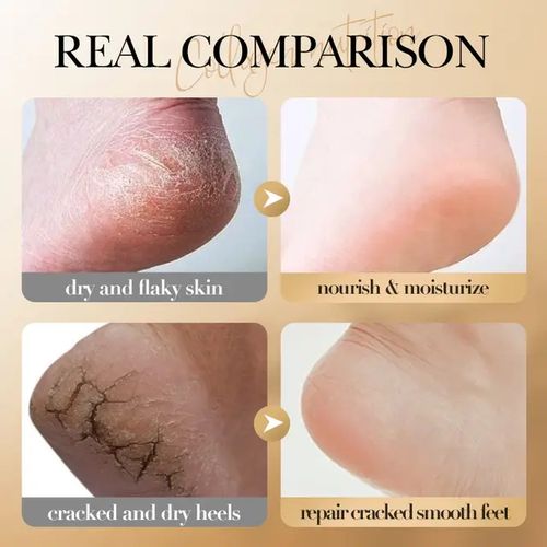 Foot Repair Cream