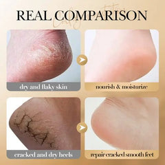 Foot Repair Cream